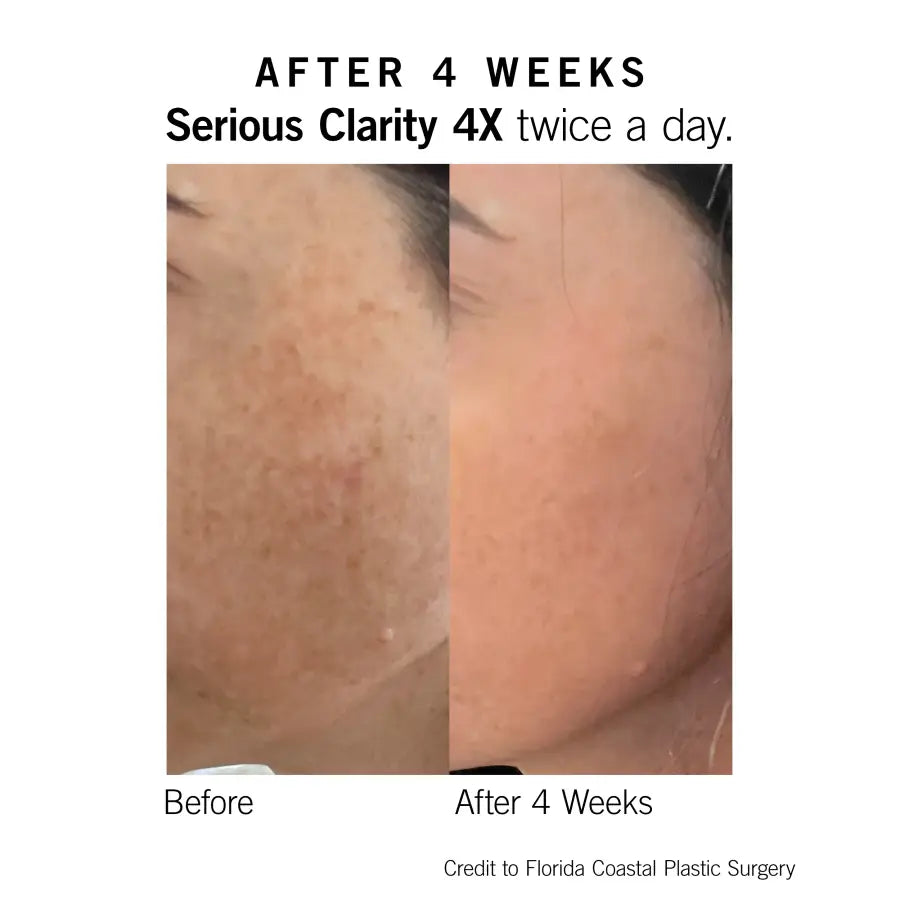 Neova SmartSkincare Serious Clarity 4X Brightening Serum