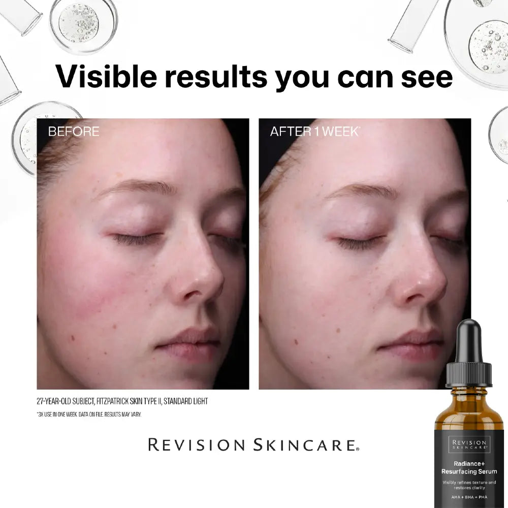 Revision Skincare Radiance+ Overnight Resurfacing Serum