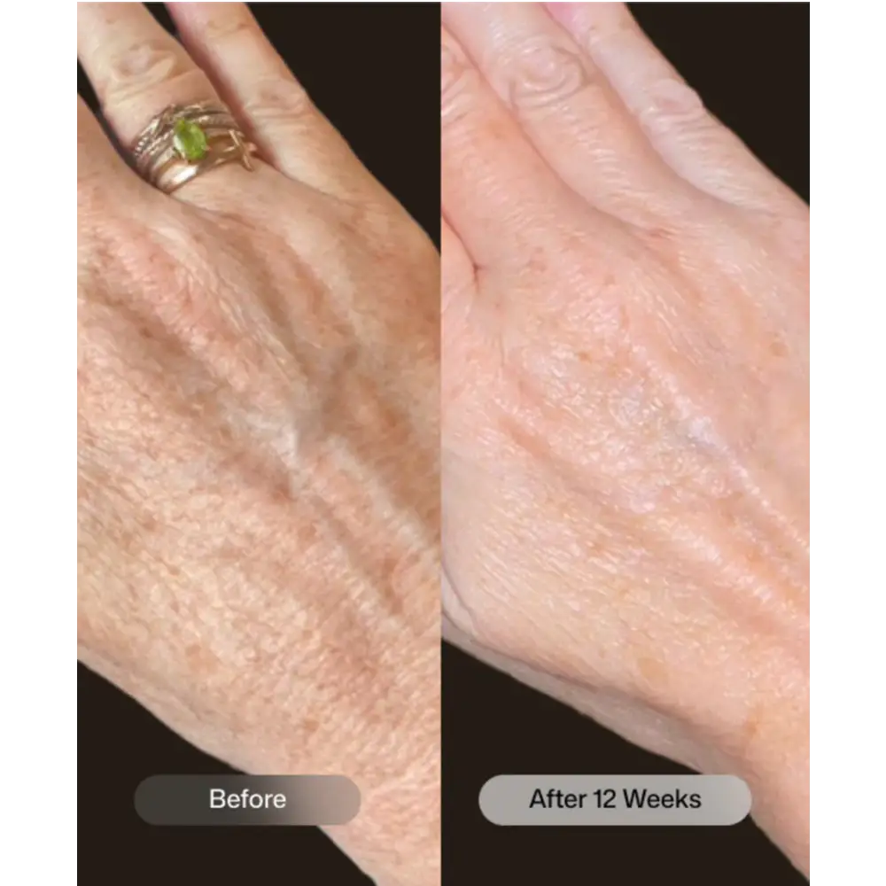 Revision Skincare YouthFull Hands Anti-Aging Hand Cream