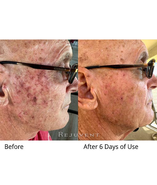 wow Results using SkinNectar