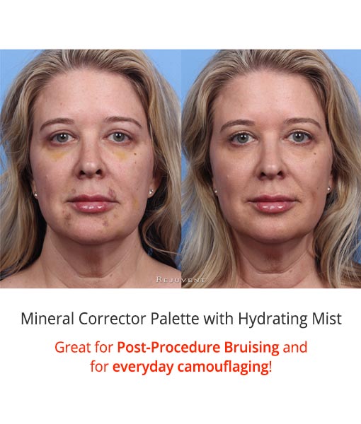 Colorescience Correcting Palette results