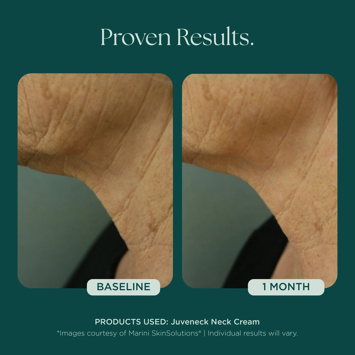 Marini SkinSolutions Juveneck Neck Cream