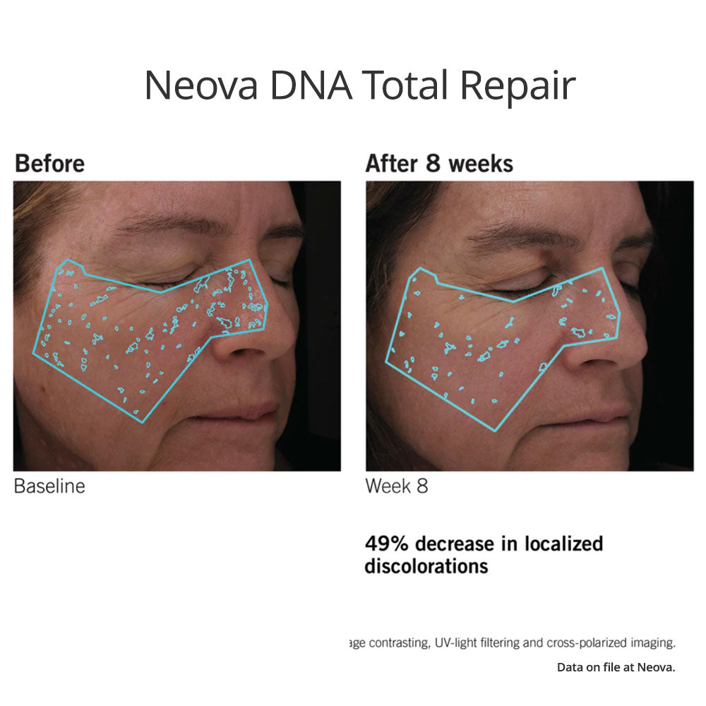 Neova DNA Total Repair results in wrinkles