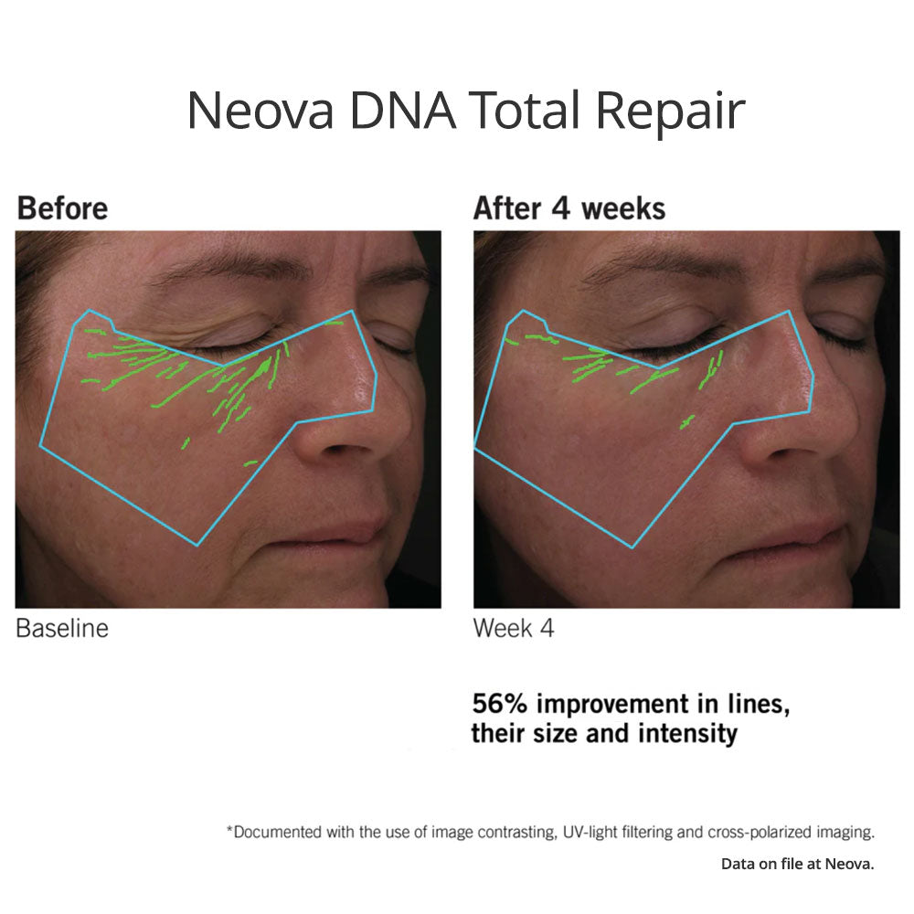 Neova DNA Total Repair results in wrinkles