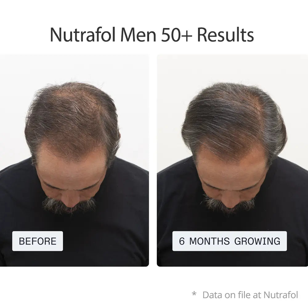 Nutrafol Hair Growth Supplements for Men 50+