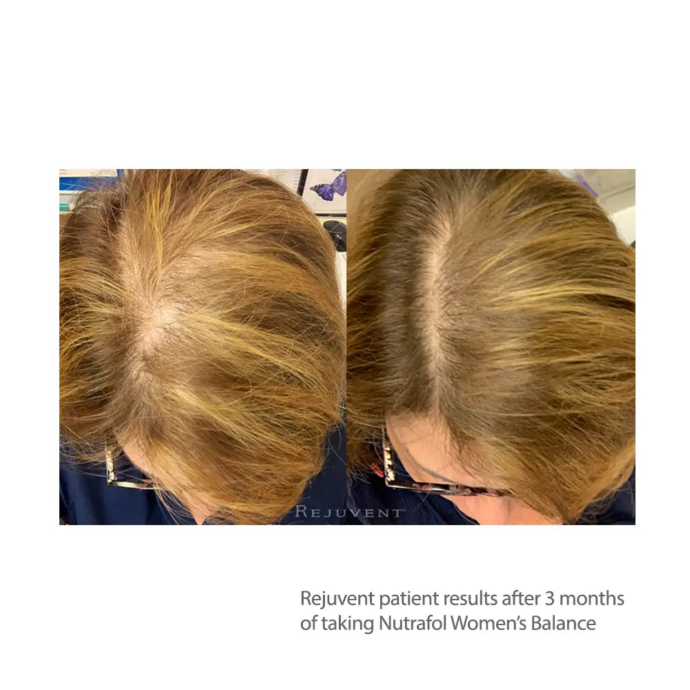 Nutrafol Women's Balance results