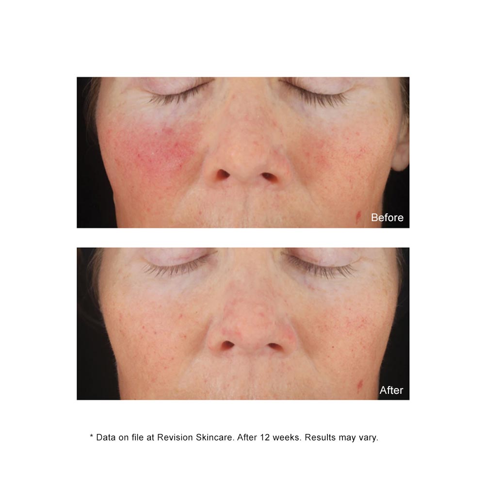 C+ Correcting Complex Results with less redness
