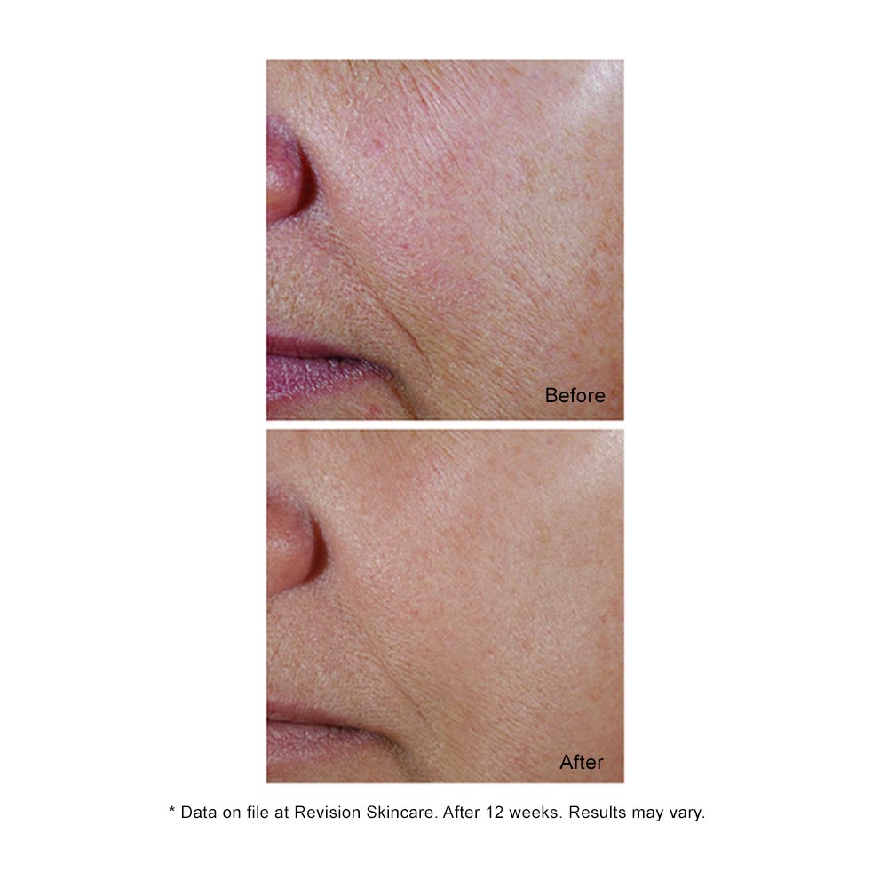 C+ Correcting Complex Results with less wrinkles