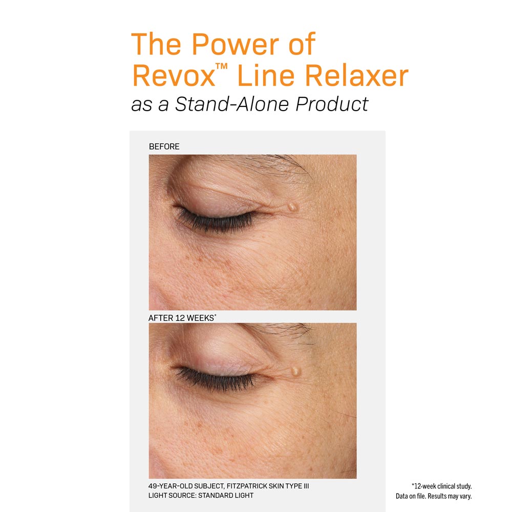 Revox Line Relaxer before and after eyes wrinkles