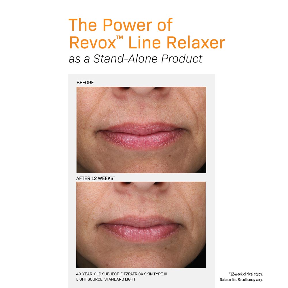 Revox Line Relaxer before and after lip wrinkles