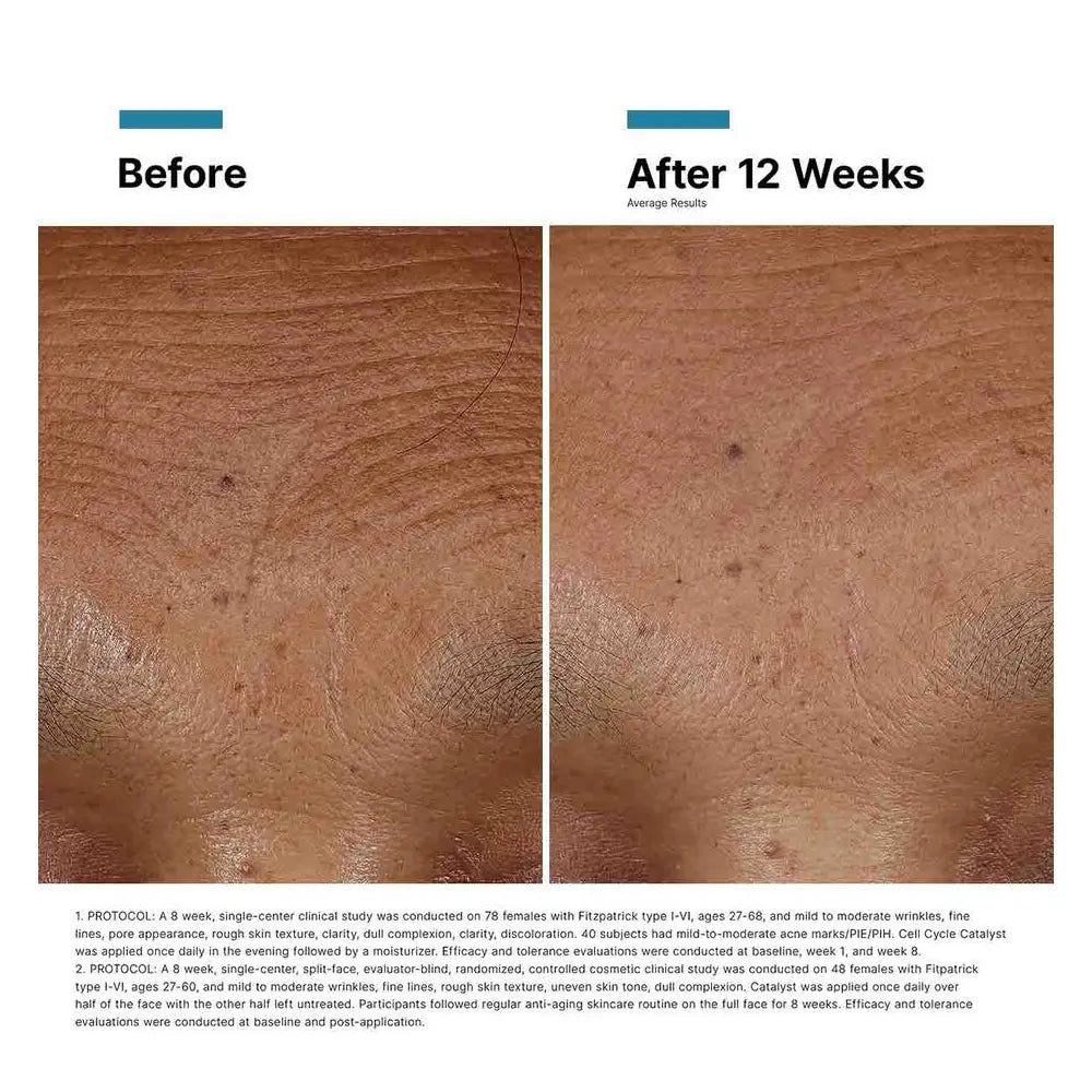 SkinCeuticals Plump and Firm Kit – Triple Lipid Restore + HA Intensifier Multi-Glycan