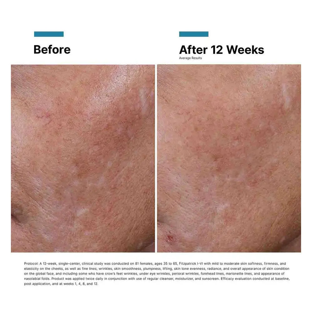 SkinCeuticals HA Intensifier Multi-Glycan results