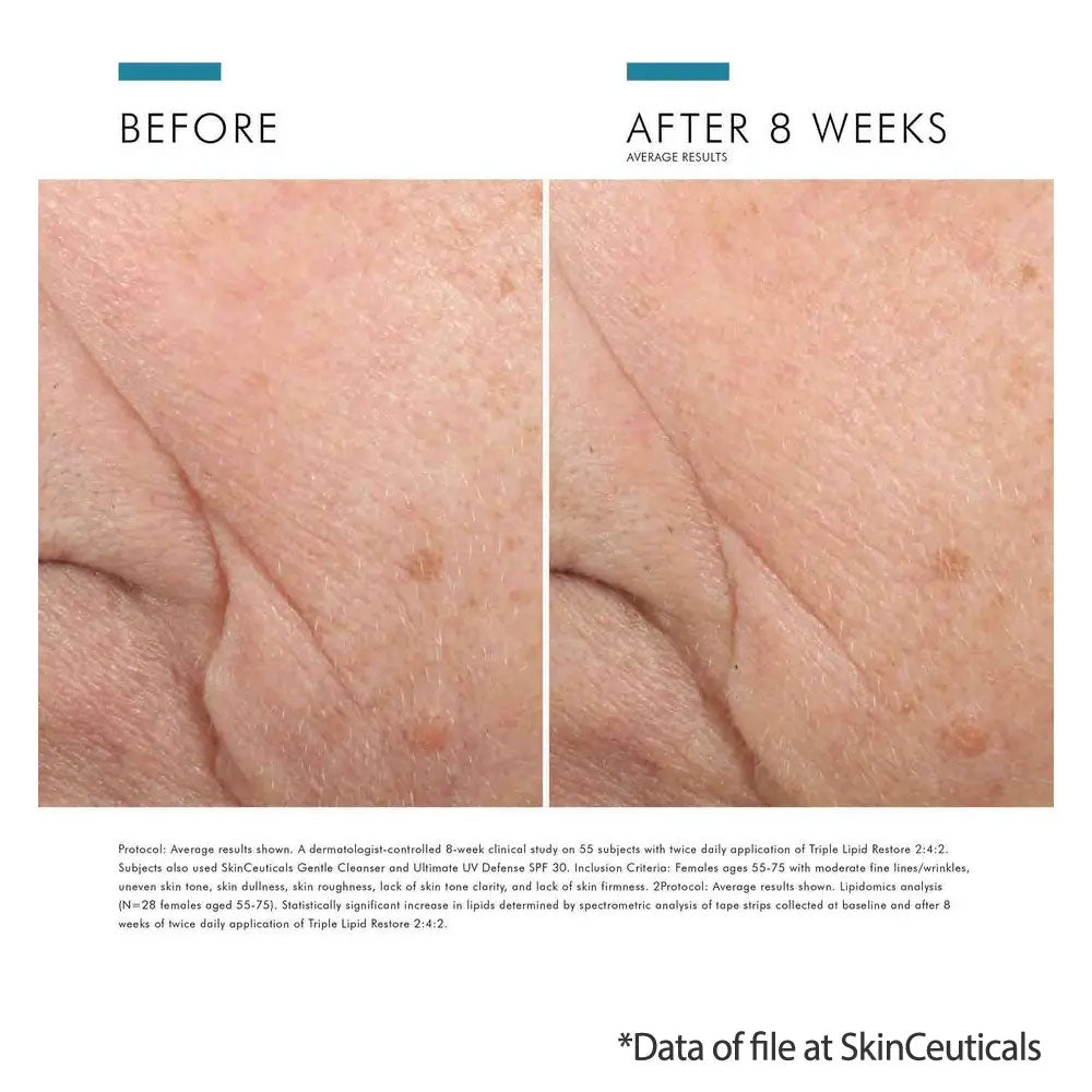 SkinCeuticals Triple Lipid Restore results
