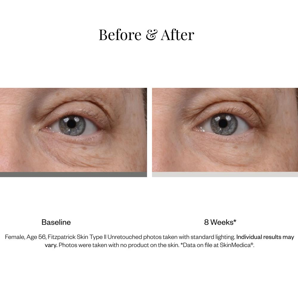 SkinMedica Instant Bright Eye Cream product results 1