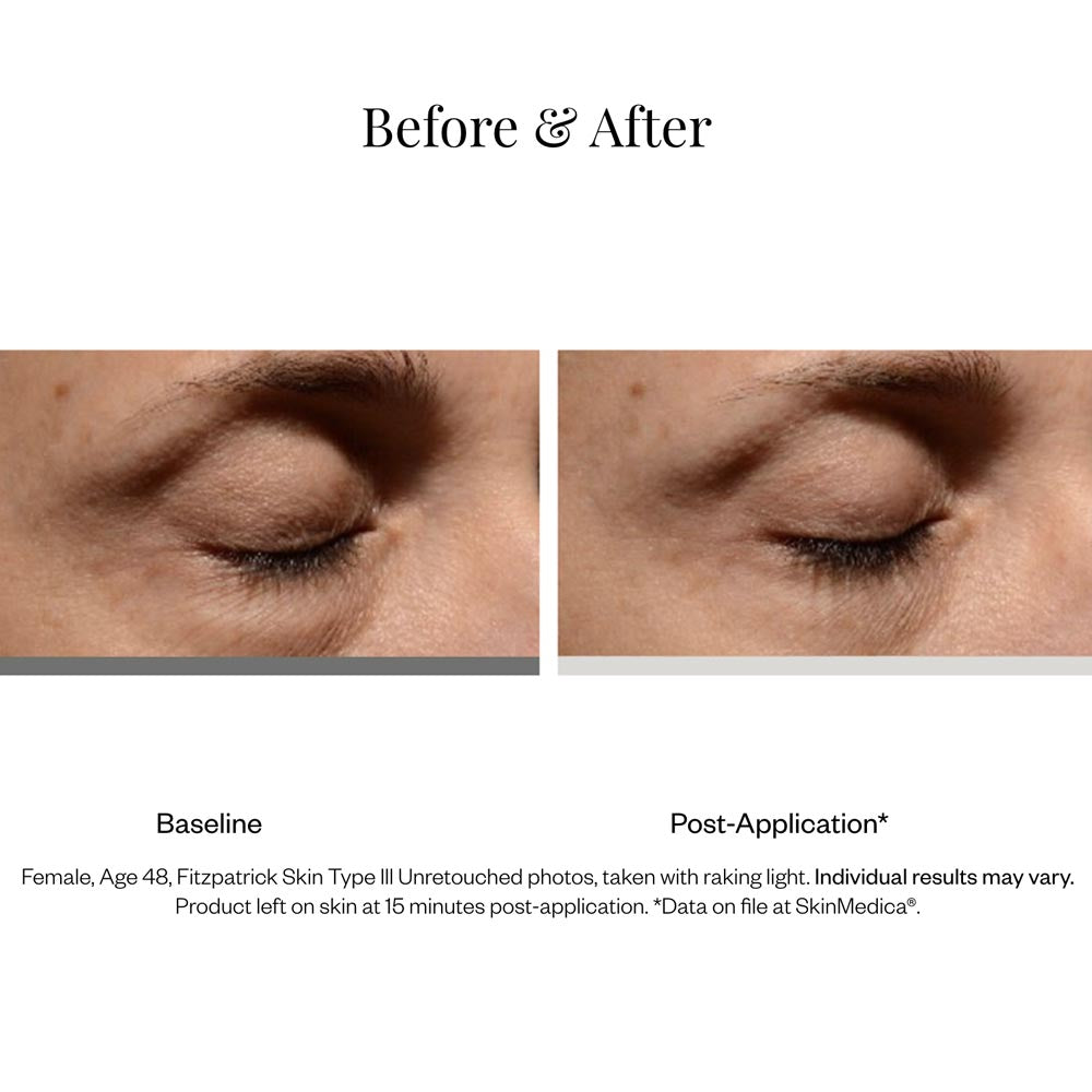 SkinMedica Instant Bright Eye Cream product results 2