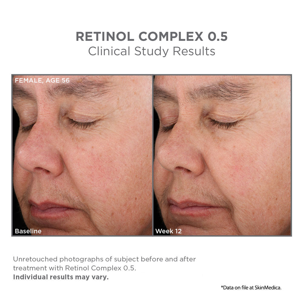SkinMedica Retinol Complex results 3