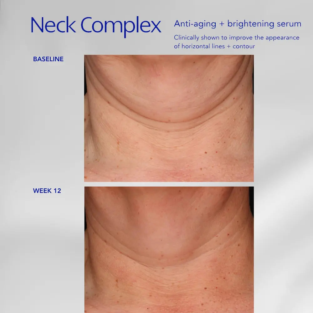 ZO Skin Health Neck Complex Anti-Aging + Brightening Serum