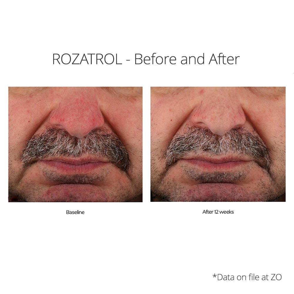 Rozatrol results on male
