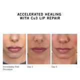 Neova SmartSkincare Cu3 Lip Repair