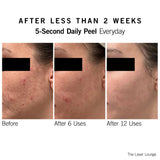 Neova SmartSkincare 5-Second Daily Peel
