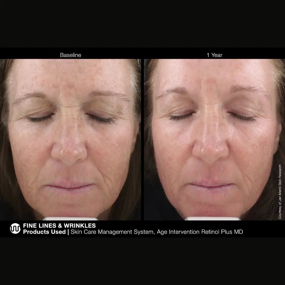 Marini SkinSolutions Retinol Plus XC (Extra Strength Retinol)