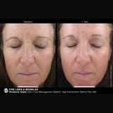 Marini SkinSolutions Retinol Plus XC (Extra Strength Retinol)