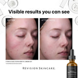 Revision Skincare Radiance+ Overnight Resurfacing Serum