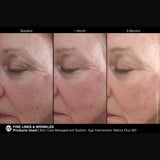 Marini SkinSolutions Retinol Plus XC (Extra Strength Retinol)