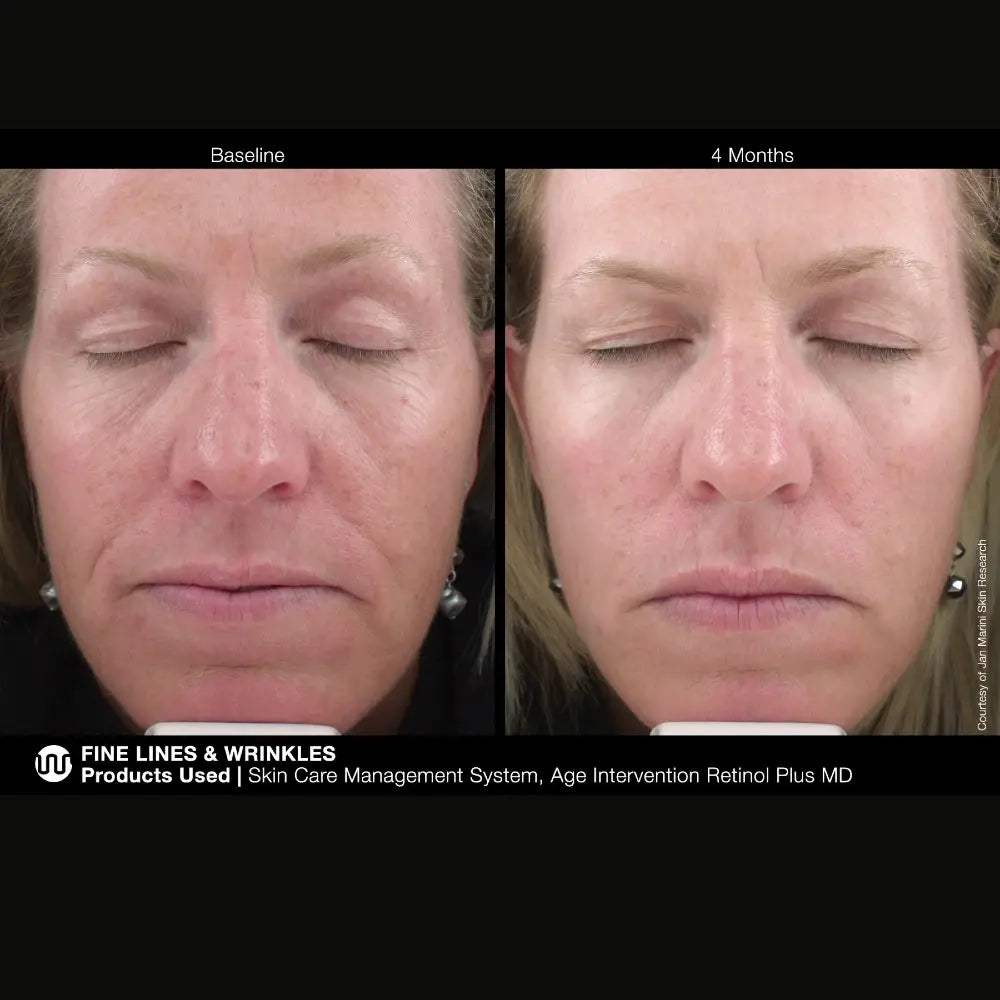 Marini SkinSolutions Retinol Plus XC (Extra Strength Retinol)