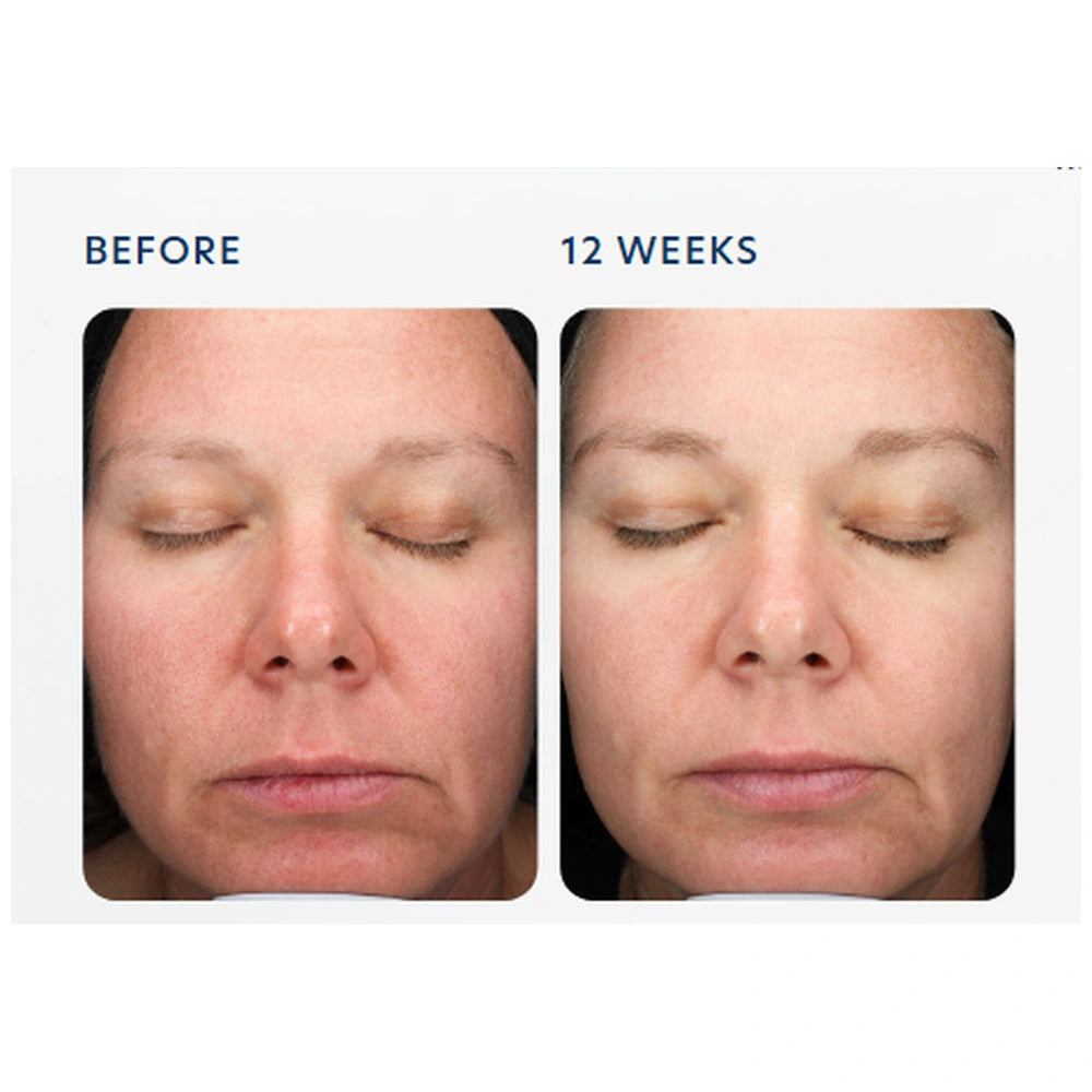PCA Skin Triple Exfoliation Peel Pads