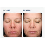 PCA Skin Triple Exfoliation Peel Pads