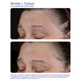 ZO Skin Health Wrinkle + Texture Retinol