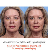 Colorescience Correcting Palette results