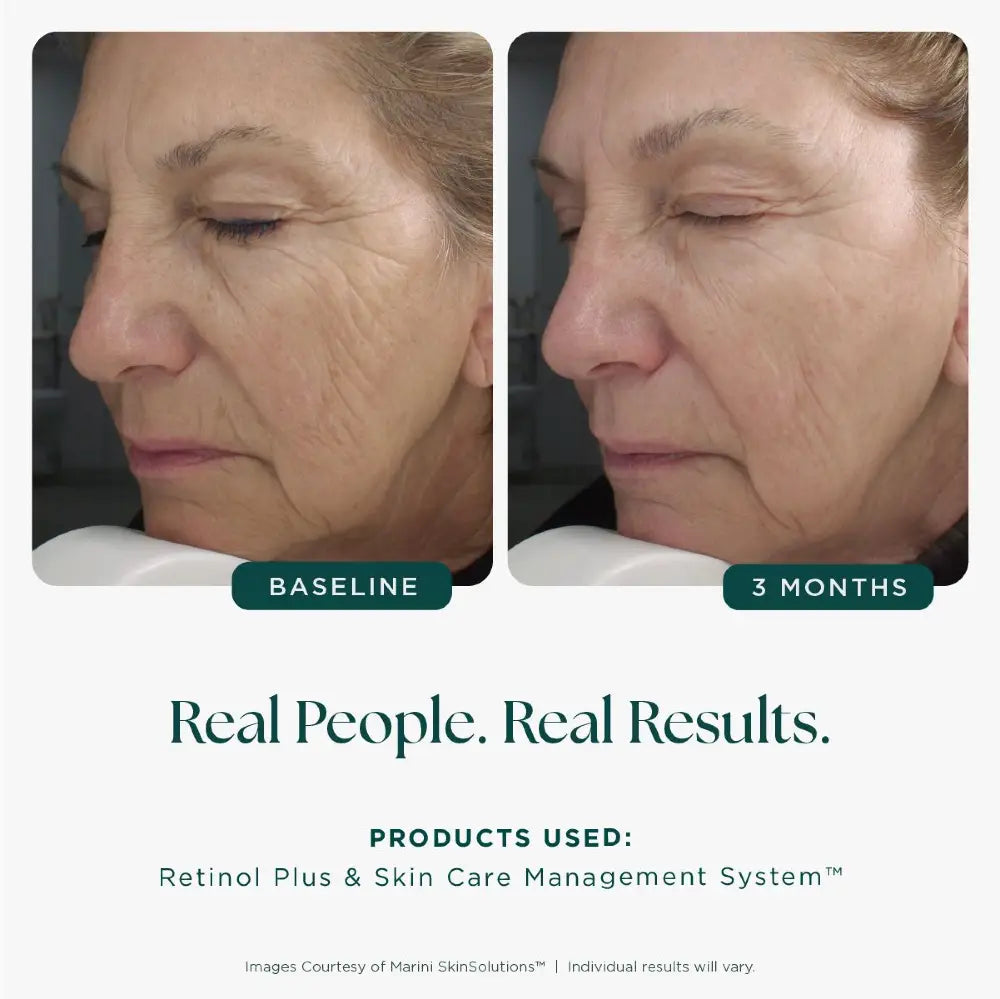 Marini SkinSolutions Retinol Plus XC (Extra Strength Retinol)