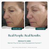 Marini SkinSolutions Retinol Plus XC (Extra Strength Retinol)