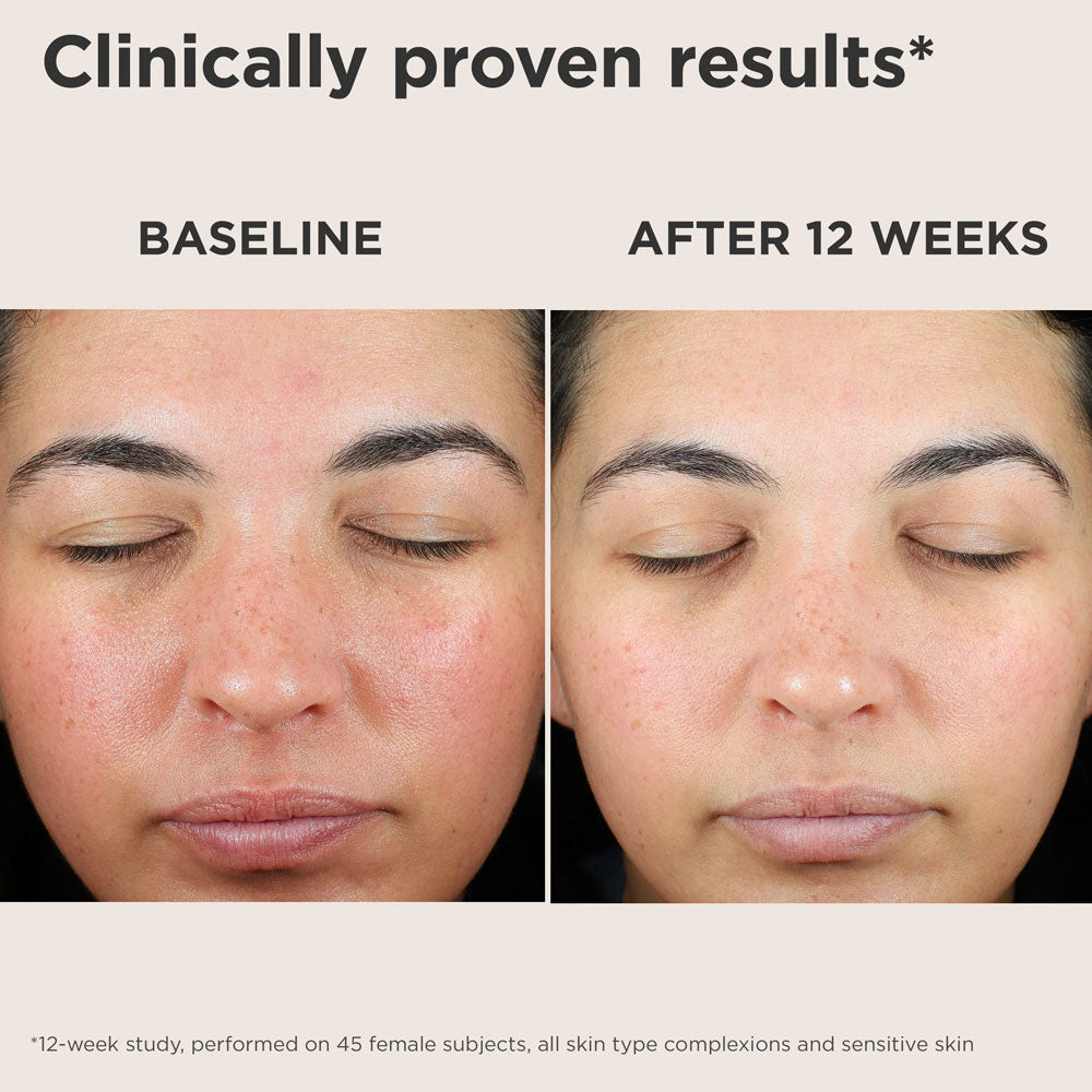 EltaMD UV Skin Recovery Broad Spectrum SPF 50 Face Sunscreen (Untinted)