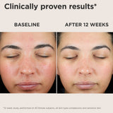 EltaMD UV Skin Recovery Broad Spectrum SPF 50 Face Sunscreen (Untinted)