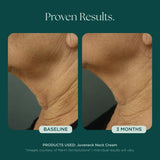 Marini SkinSolutions Juveneck Neck Cream