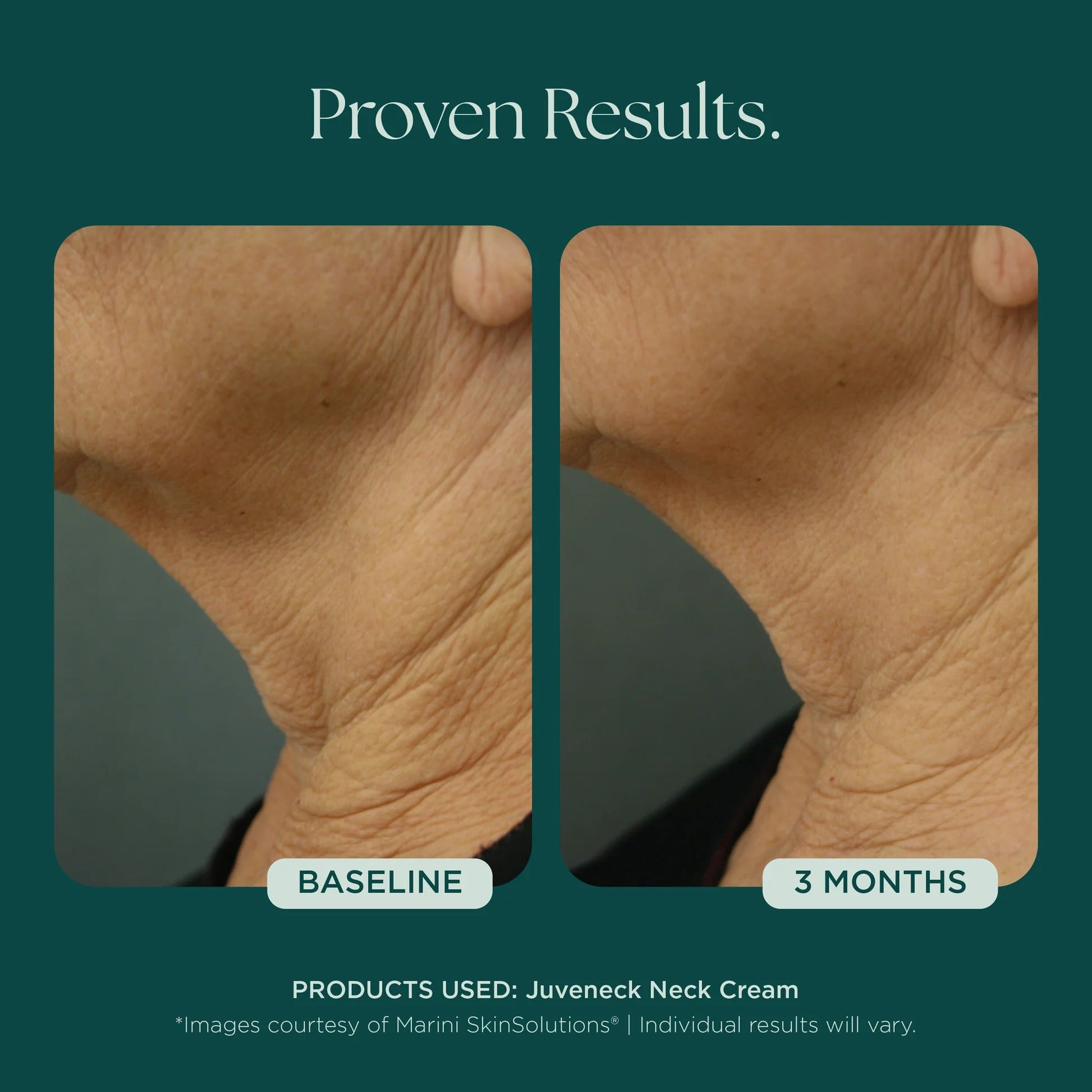 Marini SkinSolutions Juveneck Neck Cream