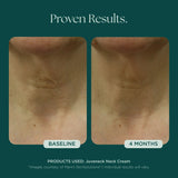 Marini SkinSolutions Juveneck Neck Cream