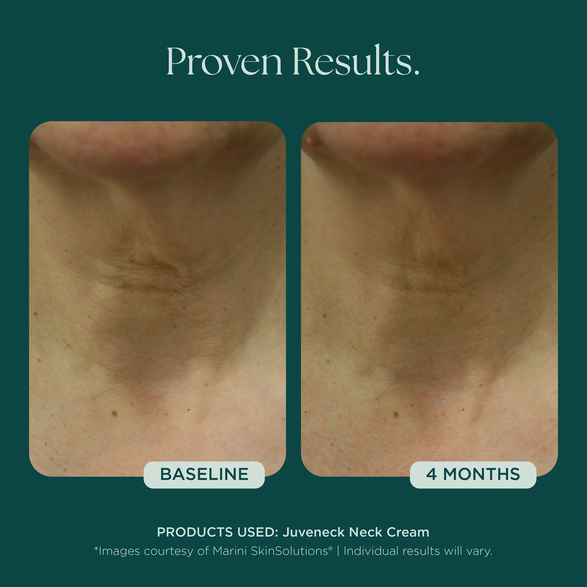 Marini SkinSolutions Juveneck Neck Cream