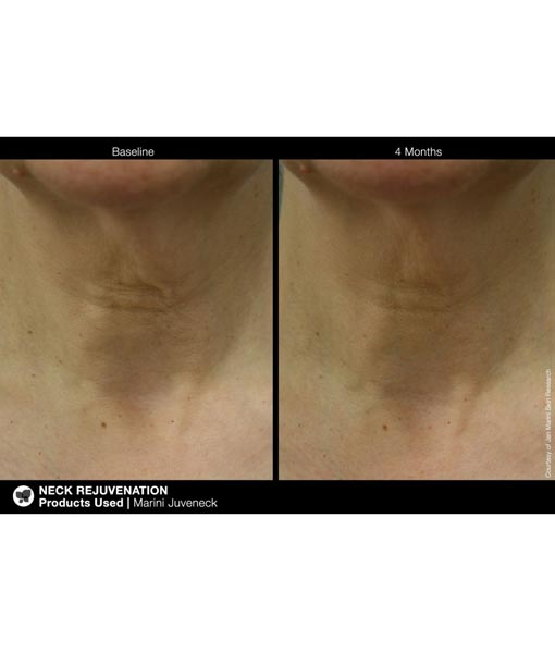 Jan Marini Juveneck Neck Cream