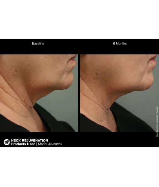 Jan Marini Juveneck Neck Cream