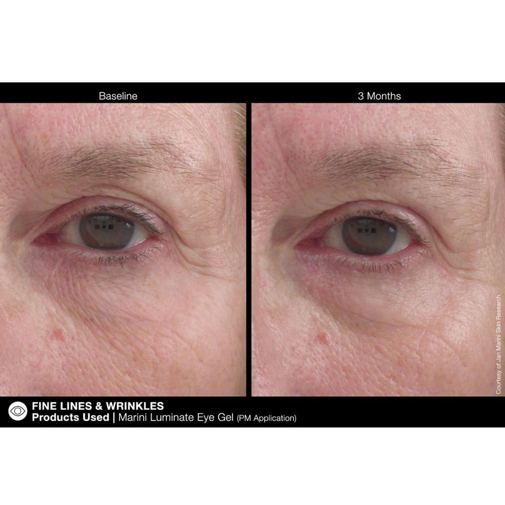Marini Luminate Retinol Eye Gel for Dark Circles | Rejuvent Skincare