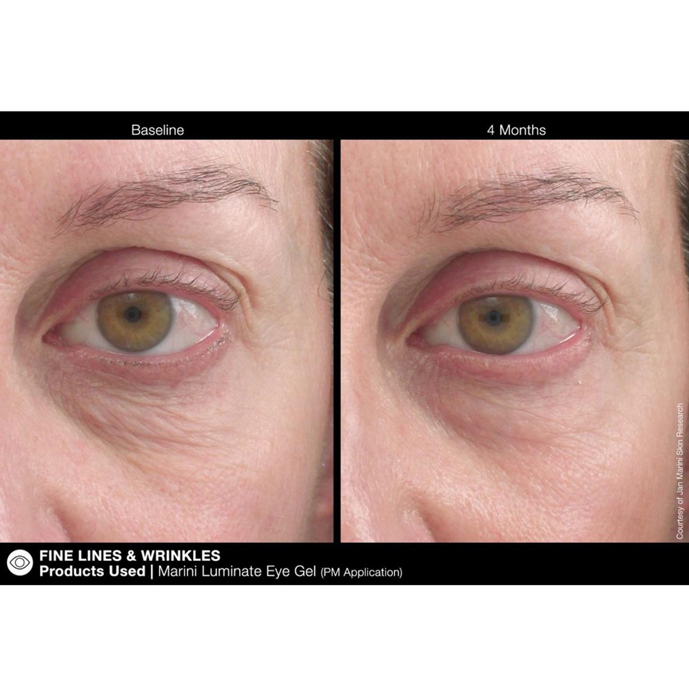 Marini Luminate Retinol Eye Gel for Dark Circles | Rejuvent Skincare