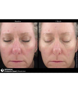 Jan Marini Rosalieve Before and after