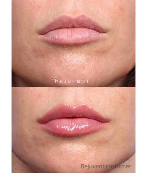 Clinicians Complex Lip Enhancer