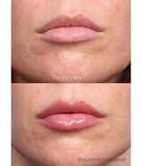 Clinicians Complex Lip Enhancer