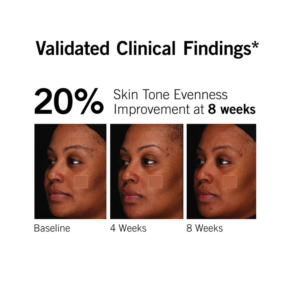 Neova C 20 + Antioxidant Serum results on darker skin shows 20% improvement
