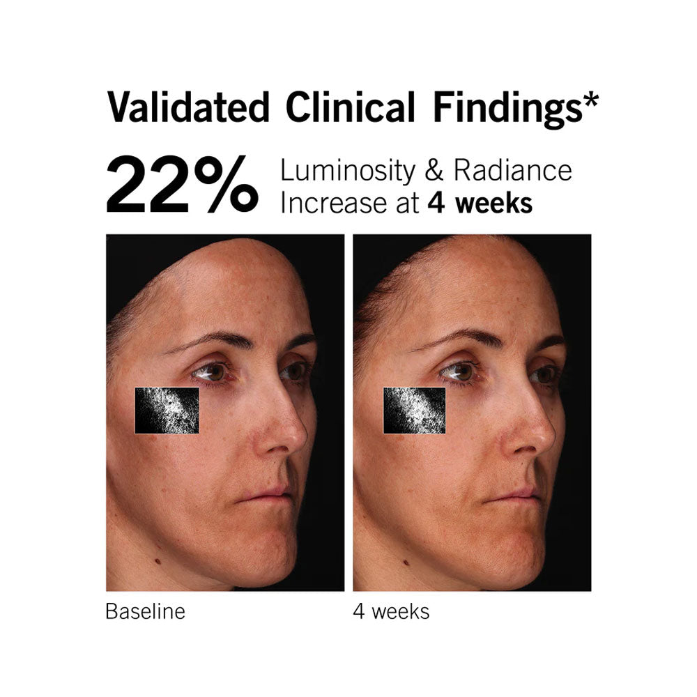 Neova C 20 + Antioxidant Serum results on white skin shows 22% improvement